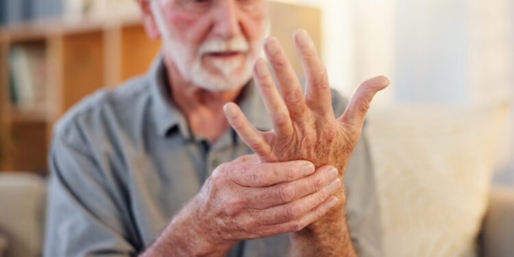 Osteoporozė: simptomai, priežastys ir gydymas