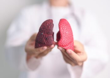 MAC plaučių liga: priežastys, simptomai ir gydymas