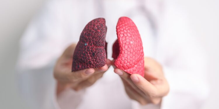 MAC plaučių liga: priežastys, simptomai ir gydymas