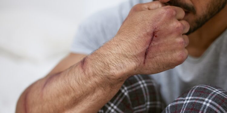 Paranoidiniai asmenybės sutrikimai: simptomai ir gydymas