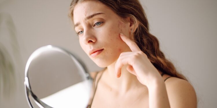 Plaukų suveržimo sindromas: simptomai, priežastys ir gydymas