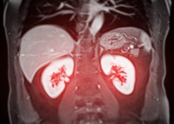 Inkstų cistos: priežastys, simptomai, gydymas ir profilaktika