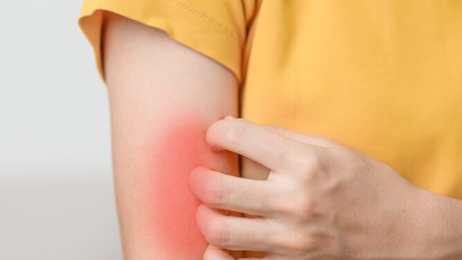 Kiek laiko trunka alerginė reakcija į maistą?