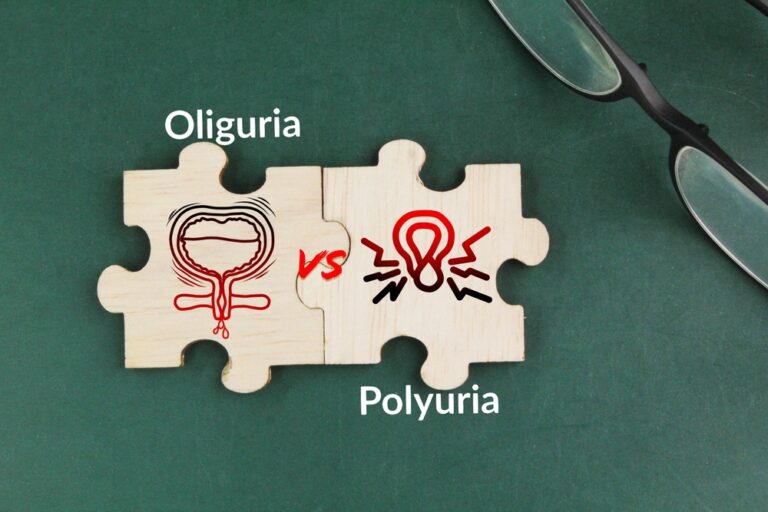 Oligurija (mažas šlapimo kiekis): priežastys, simptomai ir gydymas