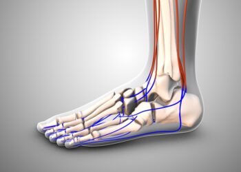 Blauzdikaulio šoninių sausgyslių uždegimas: priežastys, gydymas ir profilaktika