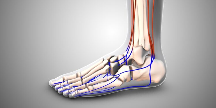 Blauzdikaulio šoninių sausgyslių uždegimas: priežastys, gydymas ir profilaktika