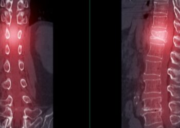 Pirmasis juosmens slankstelis