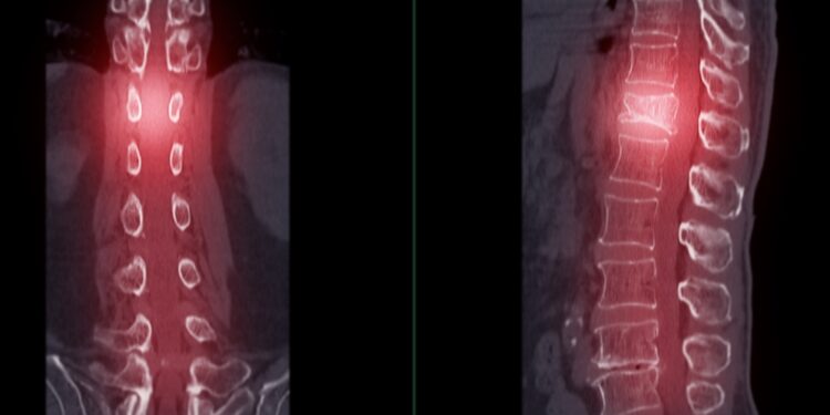 Pirmasis juosmens slankstelis