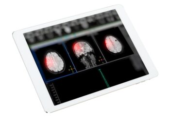 Metabolinė encefalopatija: kas tai, priežastys ir simptomai