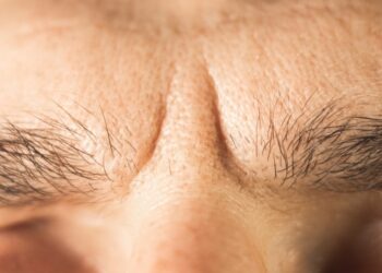 Hipotropija: kas tai, simptomai, priežastys ir gydymas