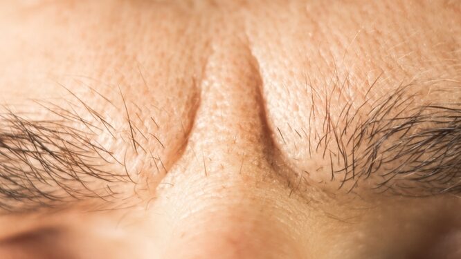 Hipotropija: kas tai, simptomai, priežastys ir gydymas