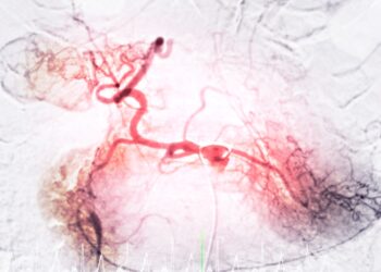 Kepenų dariniai: tipai, simptomai ir priežastys