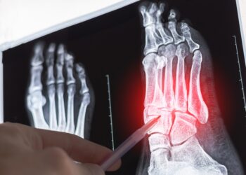 Padikaulių skausmas: simptomai ir gydymas