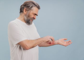 Numulinė egzema ir grybelis (žiedinė dedervinė): priežastys, simptomai, gydymas