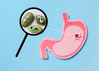 Ar Helicobacter pylori gali sukelti dirgliosios žarnos sindromą?