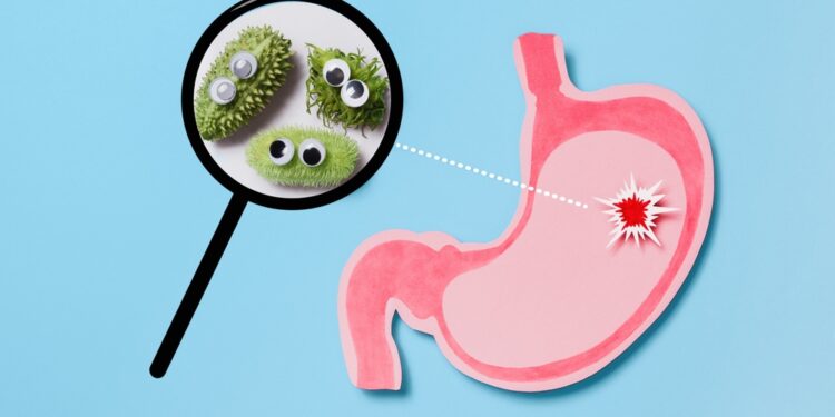 Ar Helicobacter pylori gali sukelti dirgliosios žarnos sindromą?