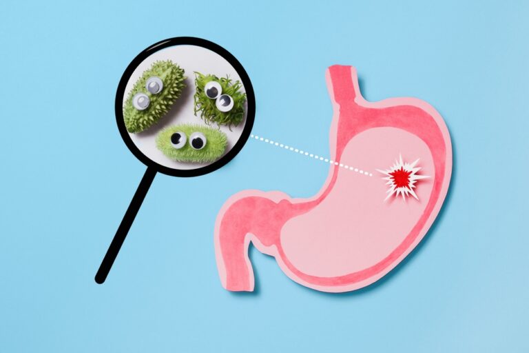 Ar Helicobacter pylori gali sukelti dirgliosios žarnos sindromą?