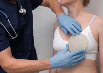 Gigantomastija: priežastys, simptomai, diagnostika ir gydymas