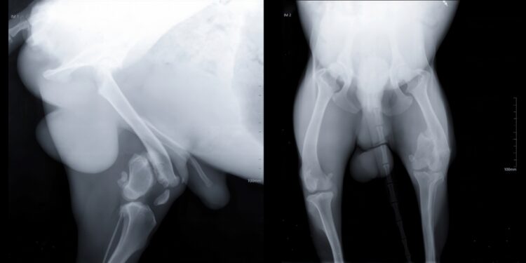Klubo displazija: simptomai, priežastys ir gydymas