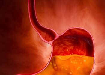 H. pylori infekcija: simptomai, priežastys ir gydymas