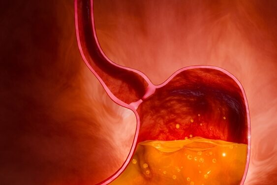 H. pylori infekcija: simptomai, priežastys ir gydymas