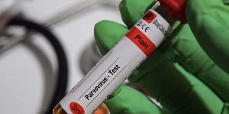 Parvovirusas B19: infekcija, priežastys, simptomai ir gydymas