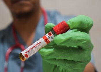 Mažas baltųjų kraujo kūnelių kiekis (leukopenija): priežastys, simptomai ir gydymas