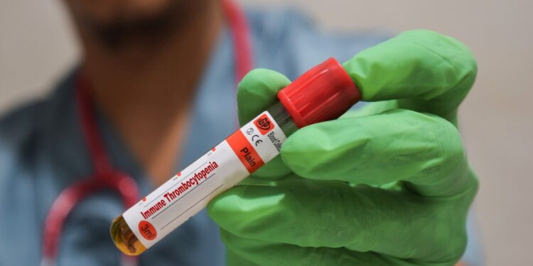 Mažas baltųjų kraujo kūnelių kiekis (leukopenija): priežastys, simptomai ir gydymas