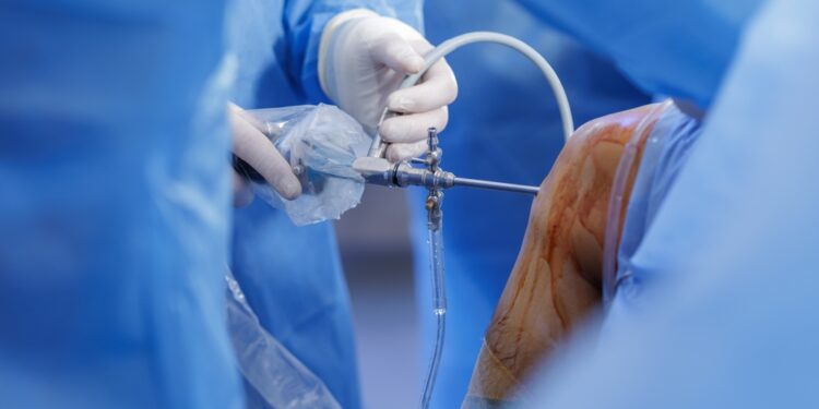 Girnelės nestabilumas: kas tai, simptomai ir gydymas