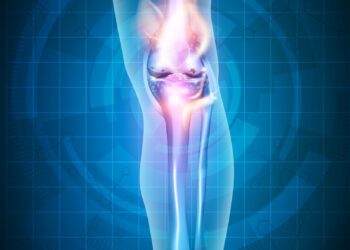 Kas yra metabolinė kaulų liga?