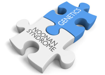 Noonano sindromas (LEOPARD sindromas): Priežastys ir prognozė