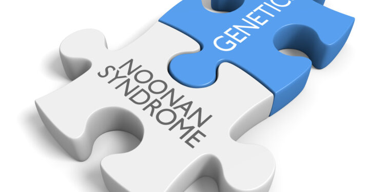 Noonano sindromas (LEOPARD sindromas): Priežastys ir prognozė