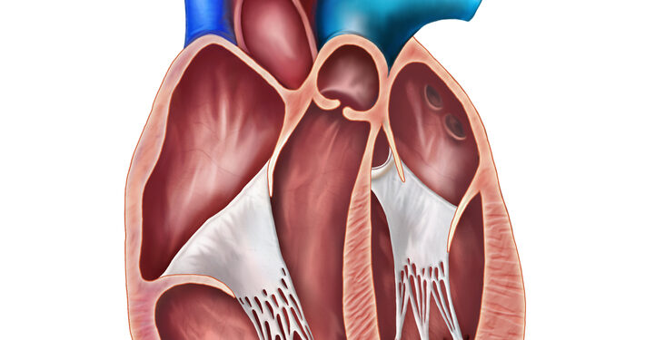 Dalinis nenormalus plautinių venų grįžimas (PAPVR)