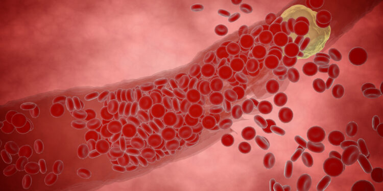 Mažas baltymų kiekis kraujyje (hipoproteinemija): priežastys ir gydymas