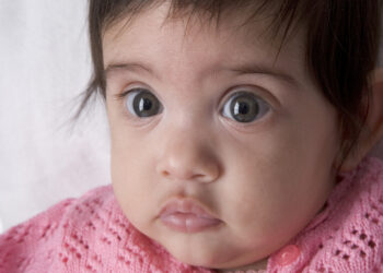 Pfeiferio sindromas: simptomai, priežastys, diagnostika, gydymas