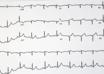 Kairiojo priekinio laidelio blokada: priežastys ir gydymas