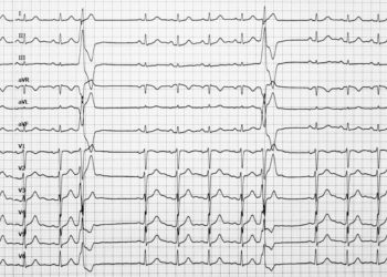 Kairiojo užpakalinio pluošto blokada: priežastys ir gydymas
