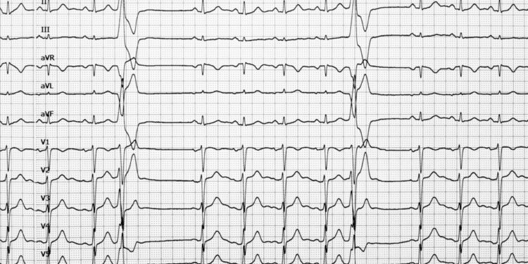 Kairiojo užpakalinio pluošto blokada: priežastys ir gydymas