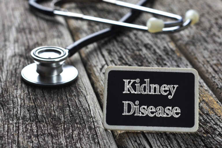Glomerulonefritas: priežastys, simptomai, diagnostika ir gydymas