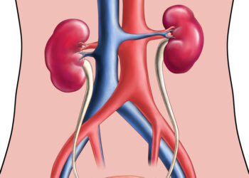 Megaureteris: priežastys, simptomai, diagnostika ir gydymas
