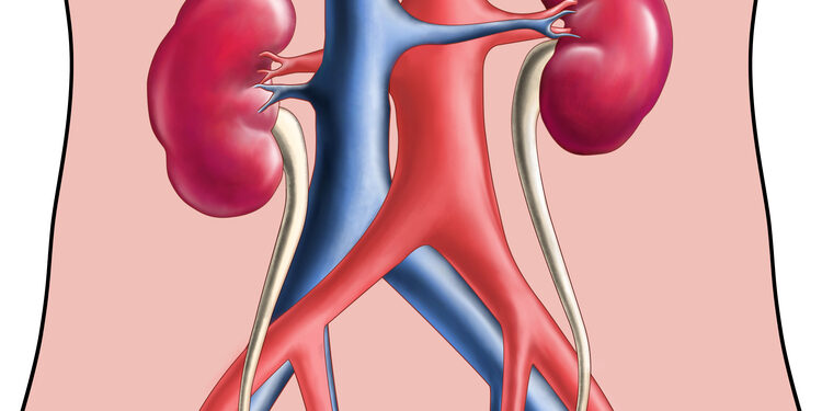 Megaureteris: priežastys, simptomai, diagnostika ir gydymas