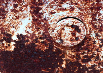 Melanozė kolone: kas tai, priežastys ir ar galima išgydyti