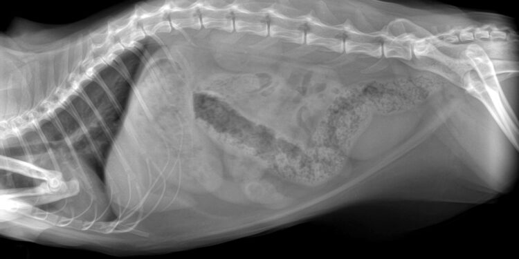 Fekalijų susikaupimas: kas tai ir kaip gydoma