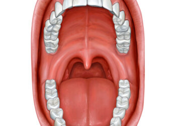 Peritonzilinis pūlinys (angina): simptomai, gydymas ir priežastys