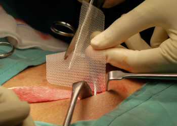 Inguinalinė granuloma (donovanozė): simptomai ir gydymas