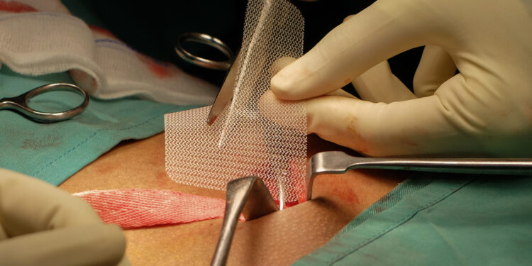 Inguinalinė granuloma (donovanozė): simptomai ir gydymas