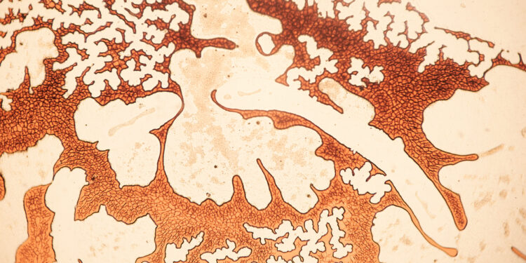 Granulocitozė: simptomai, priežastys ir gydymas