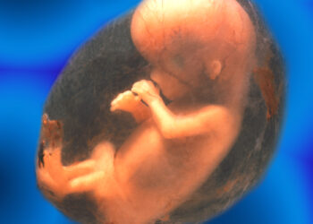 Nekompetentingas gimdos kaklelis: priežastys, simptomai ir gydymas