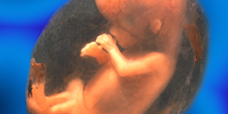 Nekompetentingas gimdos kaklelis: priežastys, simptomai ir gydymas