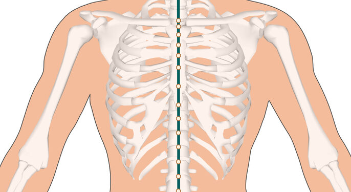 Pectus carinatum: priežastys ir gydymo būdai (krūtinės ląstos deformacija)